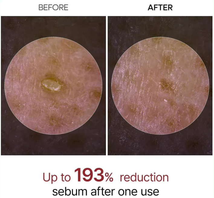 Rice husk ampoule Dr. Melaxin™