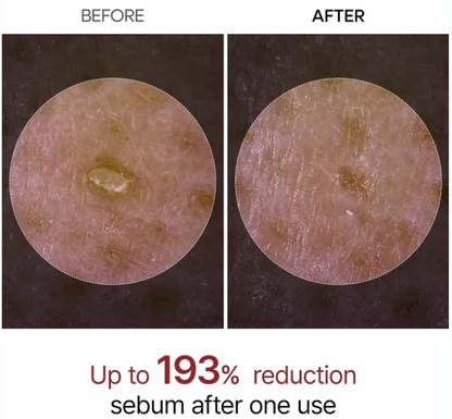Rice husk ampoule Dr. Melaxin™